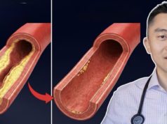 Доктор открива: Ова е најдобриот оброк за чистење на артериите и заштита на срцето
