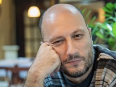 Експертите откриваат кога е најдобро време за трансплантација на коса: Многумина прават иста грешка ќелав маж
