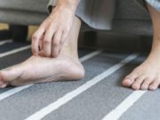 Ви отекуваат стапалата и зглобовите? Стручњаците откриваат кога симптомот може да укажува на посериозен проблем стапала
